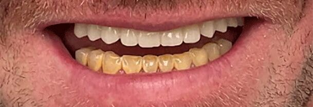After